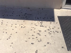 Gum Removal Long Island